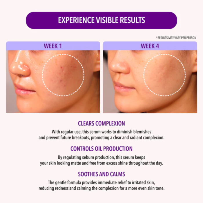 10% Niacinamide & 1.9% Salicylic Acid Oil Control Serum - Imagen 3